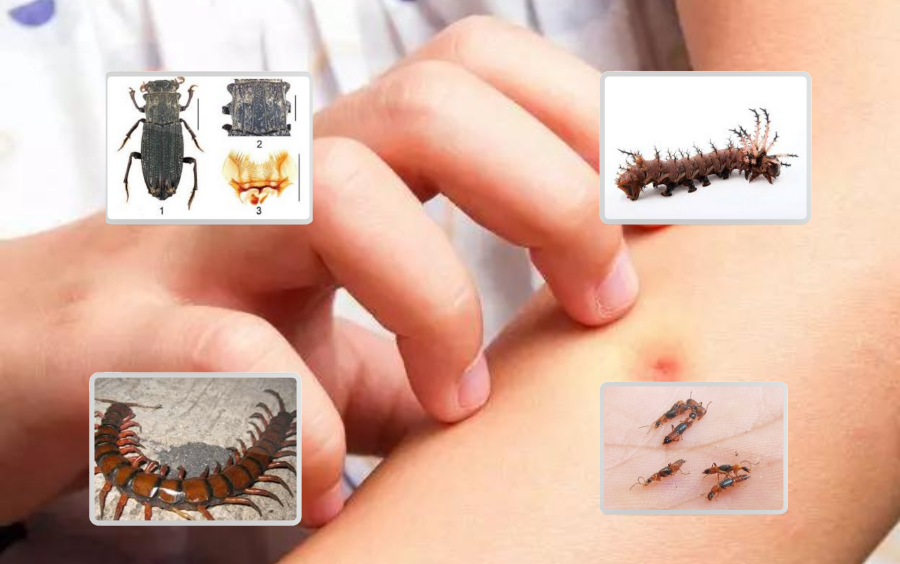 xu-ly-vet-con-trung-can