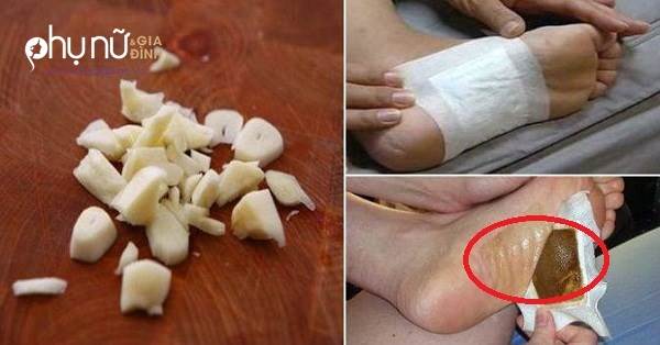Giã nát tép tỏi đắp lên gan bàn chân rồi đi ngủ, kết quả sáng hôm sau khiến mọi người thực sự sốc